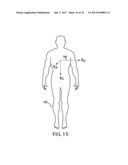 ALARM SYSTEM THAT PROCESSES BOTH MOTION AND VITAL SIGNS USING SPECIFIC     HEURISTIC RULES AND THRESHOLDS diagram and image