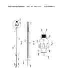 IMPLANT PLACEMENT SYSTEMS, DEVICES AND METHODS diagram and image