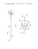 IMPLANT PLACEMENT SYSTEMS, DEVICES AND METHODS diagram and image