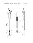 IMPLANT PLACEMENT SYSTEMS, DEVICES AND METHODS diagram and image