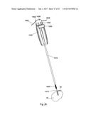 IMPLANT PLACEMENT SYSTEMS, DEVICES AND METHODS diagram and image