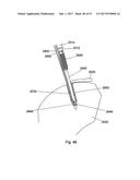 IMPLANT PLACEMENT SYSTEMS, DEVICES AND METHODS diagram and image