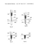 IMPLANT PLACEMENT SYSTEMS, DEVICES AND METHODS diagram and image