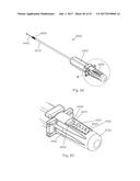 IMPLANT PLACEMENT SYSTEMS, DEVICES AND METHODS diagram and image