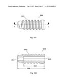 IMPLANT PLACEMENT SYSTEMS, DEVICES AND METHODS diagram and image