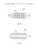 IMPLANT PLACEMENT SYSTEMS, DEVICES AND METHODS diagram and image