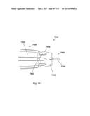 IMPLANT PLACEMENT SYSTEMS, DEVICES AND METHODS diagram and image