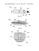 IMPLANT PLACEMENT SYSTEMS, DEVICES AND METHODS diagram and image