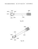 IMPLANT PLACEMENT SYSTEMS, DEVICES AND METHODS diagram and image