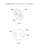 IMPLANT PLACEMENT SYSTEMS, DEVICES AND METHODS diagram and image