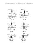 IMPLANT PLACEMENT SYSTEMS, DEVICES AND METHODS diagram and image