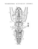 Endoscopic Stitching Devices diagram and image