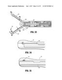 Endoscopic Stitching Devices diagram and image