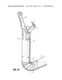 Endoscopic Stitching Devices diagram and image