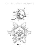 Endoscopic Stitching Devices diagram and image