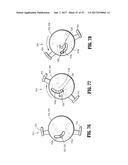 Endoscopic Stitching Devices diagram and image