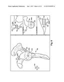 SYSTEM AND METHOD FOR ASSOCIATION OF A GUIDING AID WITH A PATIENT TISSUE diagram and image