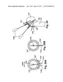 SYSTEM AND METHOD FOR ASSOCIATION OF A GUIDING AID WITH A PATIENT TISSUE diagram and image