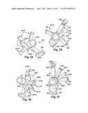 SYSTEM AND METHOD FOR ASSOCIATION OF A GUIDING AID WITH A PATIENT TISSUE diagram and image