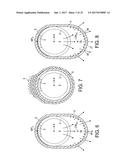 Rotational Atherectomy Device diagram and image