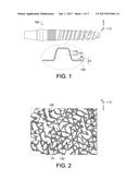 BONE IMPLANT AND MANUFACTURING METHOD THEREOF diagram and image