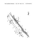 Device For Cutting Off And Removing Calcified Tissue From A Heart Valve diagram and image