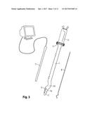 Device For Cutting Off And Removing Calcified Tissue From A Heart Valve diagram and image