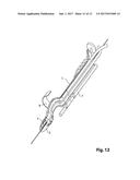 Device For Cutting Off And Removing Calcified Tissue From A Heart Valve diagram and image