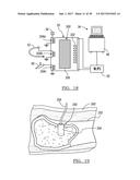 Method And Apparatus For Surgical Navigation diagram and image