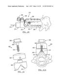 Method And Apparatus For Surgical Navigation diagram and image