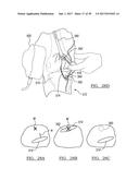 Method And Apparatus For Surgical Navigation diagram and image