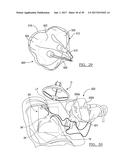 Method And Apparatus For Surgical Navigation diagram and image