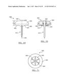 Method And Apparatus For Surgical Navigation diagram and image