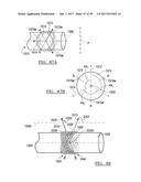 Method And Apparatus For Surgical Navigation diagram and image