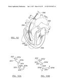 Method And Apparatus For Surgical Navigation diagram and image