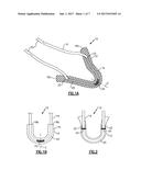 SOFT ANCHOR ASSEMBLY WITH NON-SLIDING FLEXIBLE STRAND AND TECHNIQUES FOR     USE diagram and image