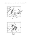 SOFT ANCHOR ASSEMBLY WITH NON-SLIDING FLEXIBLE STRAND AND TECHNIQUES FOR     USE diagram and image