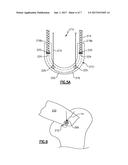 SOFT ANCHOR ASSEMBLY WITH NON-SLIDING FLEXIBLE STRAND AND TECHNIQUES FOR     USE diagram and image