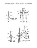 LOADING APPARATUS AND SYSTEM FOR EXPANDABLE INTRALUMINAL MEDICAL DEVICES diagram and image