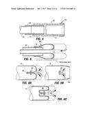 INTESTINAL SLEEVES AND ASSOCIATED DEPLOYMENT SYSTEMS AND METHODS diagram and image