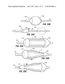 INTESTINAL SLEEVES AND ASSOCIATED DEPLOYMENT SYSTEMS AND METHODS diagram and image