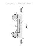 PATIENT POSITIONING SYSTEM diagram and image