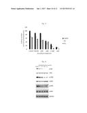 Desethylamiodarone for use in cancer treatment diagram and image