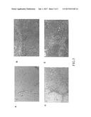 F10 Inhibits Growth of PC3 Xenografts and Enhances the Effects of     Radiation Therapy diagram and image