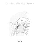 METHODS AND SYSTEMS FOR IMPROVING AIRWAY PATENCY diagram and image