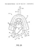 METHODS AND SYSTEMS FOR IMPROVING AIRWAY PATENCY diagram and image