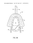 METHODS AND SYSTEMS FOR IMPROVING AIRWAY PATENCY diagram and image