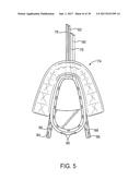 METHODS AND SYSTEMS FOR IMPROVING AIRWAY PATENCY diagram and image