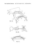 METHODS AND SYSTEMS FOR IMPROVING AIRWAY PATENCY diagram and image