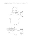 METHODS AND SYSTEMS FOR IMPROVING AIRWAY PATENCY diagram and image